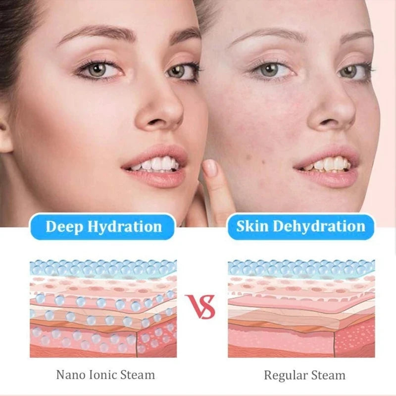 Portable Diamond Microdermabrasion Machine Facial Skin Care Blackhead Removal Beauty Device with Diamond Dermabrasion Tips