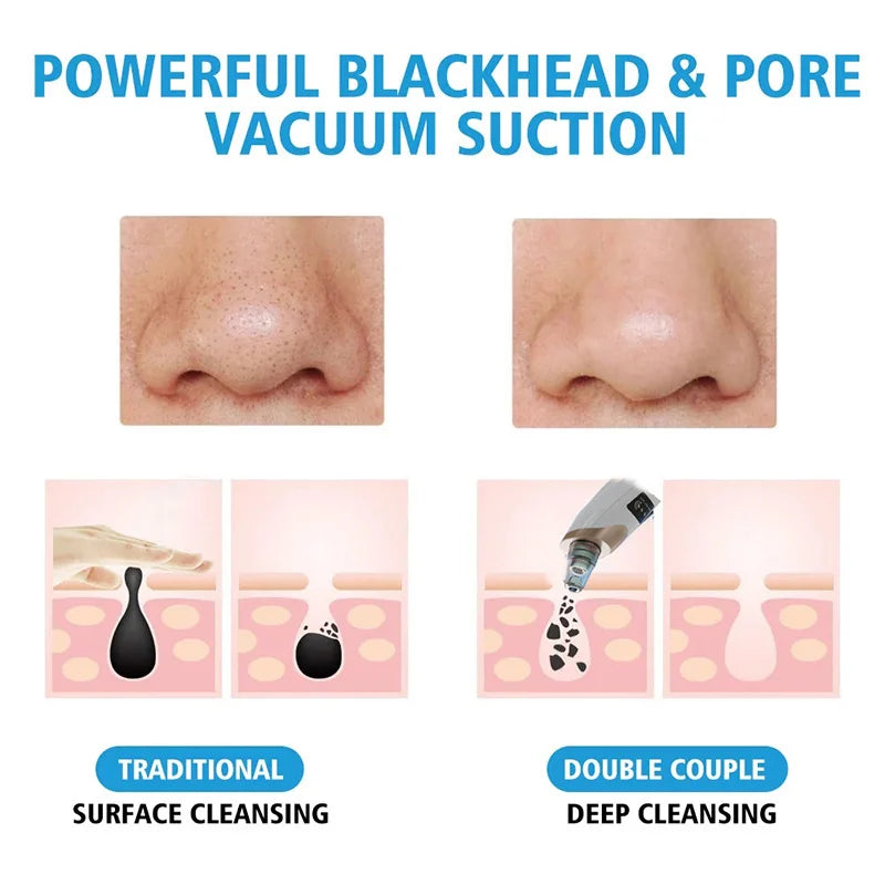 Electric Blackhead Remover Vacuum Acne Cleaner Black Dots Removal Facial Deep Cleansing Pore Cleaner Machine Skin Care Tools