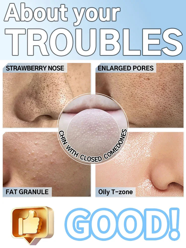 Electric Blackhead Remover Vacuum Acne Cleaner Black Dots Removal Facial Deep Cleansing Pore Cleaner Machine Skin Care Tools