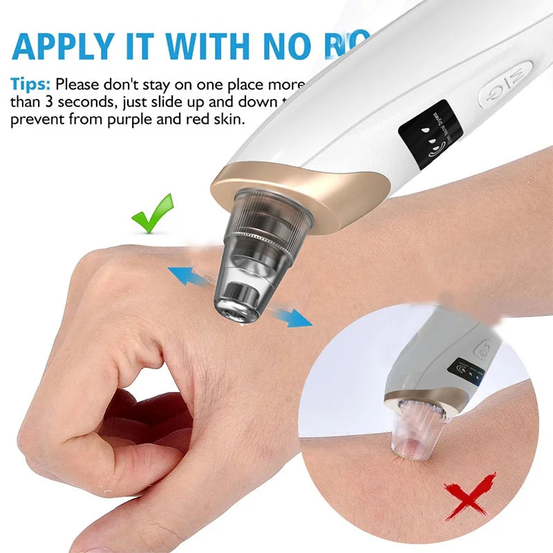 Electric Blackhead Remover Vacuum Acne Cleaner Black Dots Removal Facial Deep Cleansing Pore Cleaner Machine Skin Care Tools