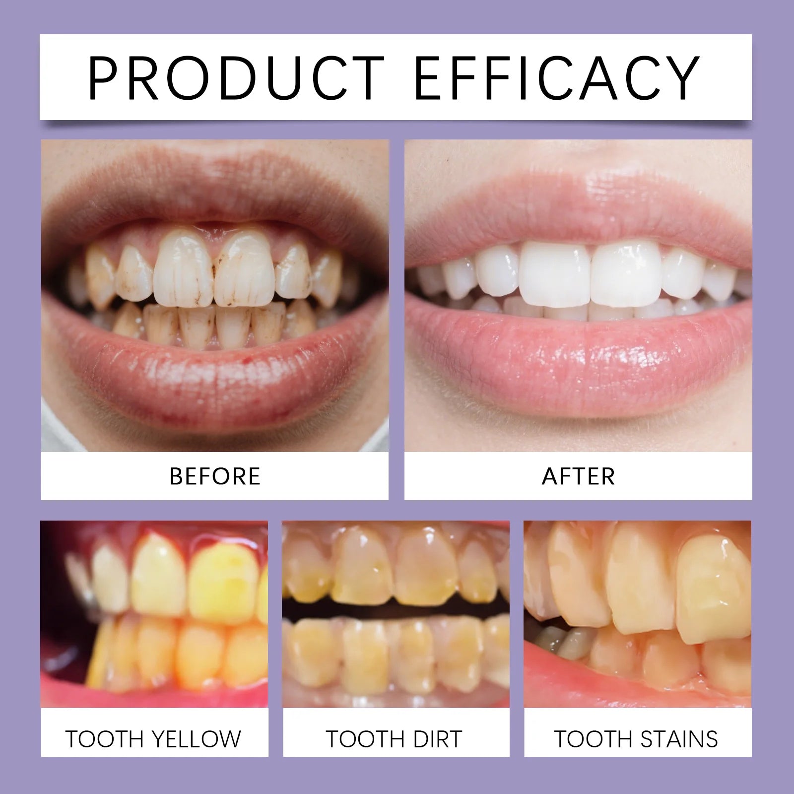 9D Purple Tooth Mousse WHITENING FOAM TOOTHPASTE 10% Hydroxyapatite Fresh Breath Travel Teeth Whitening Stain Removal Oral Care