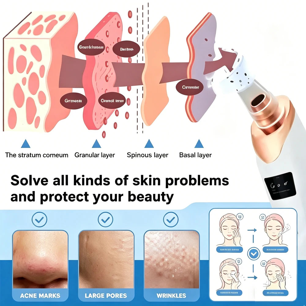 Electric Blackhead Remover Vacuum Acne Cleaner Black Dots Removal Facial Deep Cleansing Pore Cleaner Machine Skin Care Tools