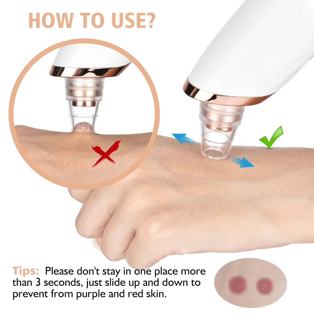 Electric Blackhead Remover Vacuum Cleaner Black Spots Removal Facial Deep Cleansing Pore Cleaner Machine Face Skin Care Tools